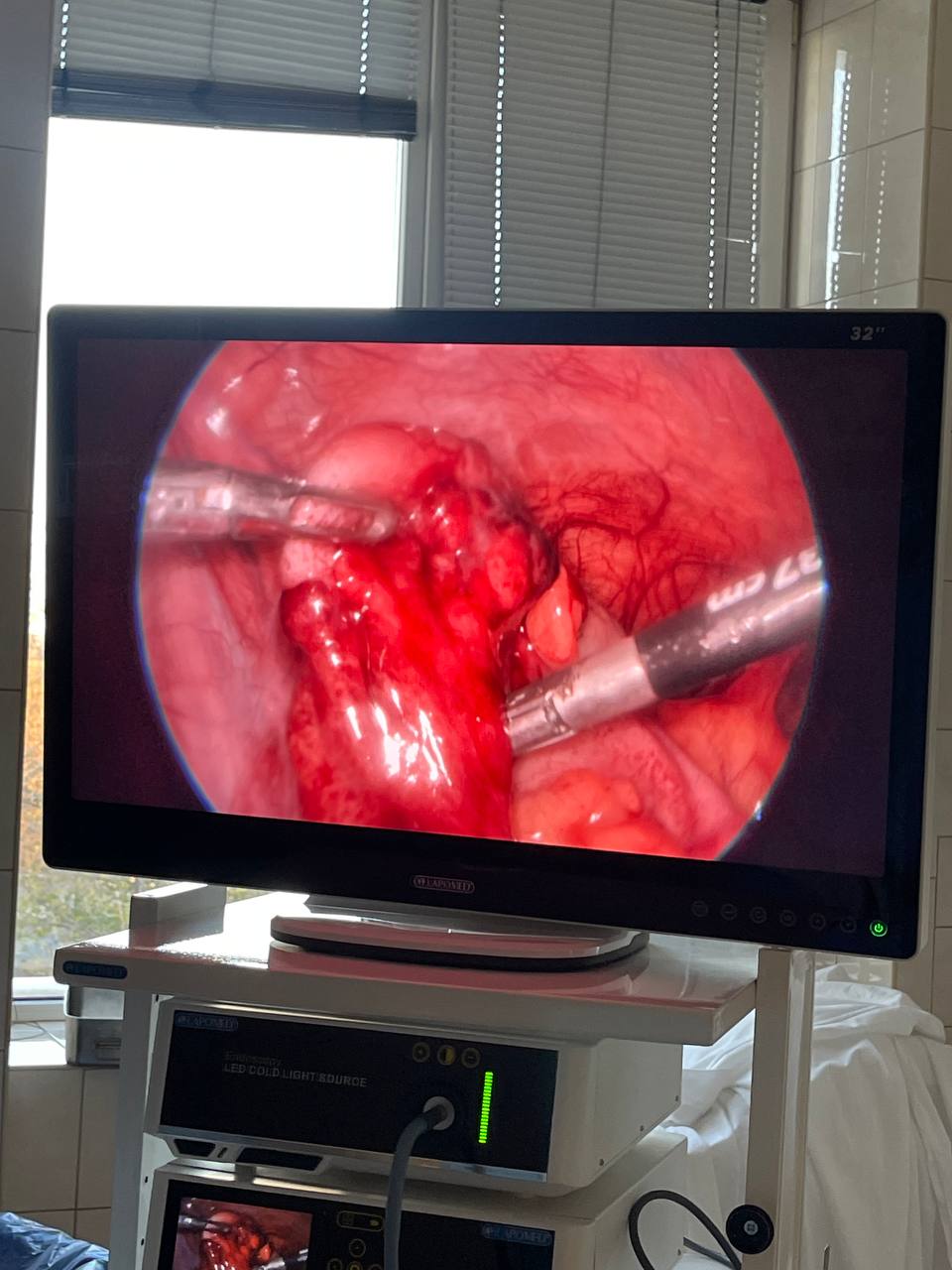 Хірург у Дніпрі лапороскопія