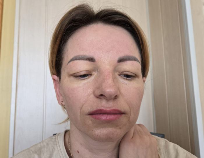 До операції