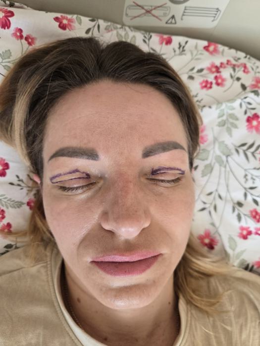 7 доба після операції